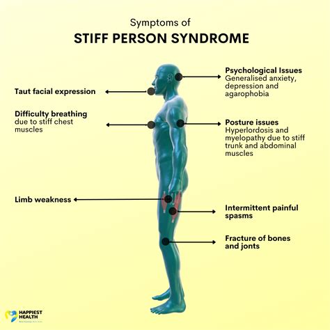 stiff person syndrome lebensgefährlich